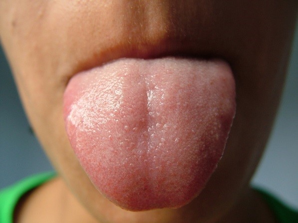 what does a healthy tongue look like